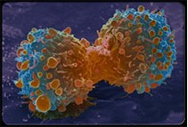 我國細胞免疫治療腫瘤或?qū)⑦M入快車道