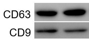 1617175642941515.png 8 外泌體標(biāo)志物鑒定 外泌體Western blot鑒定服務(wù).png